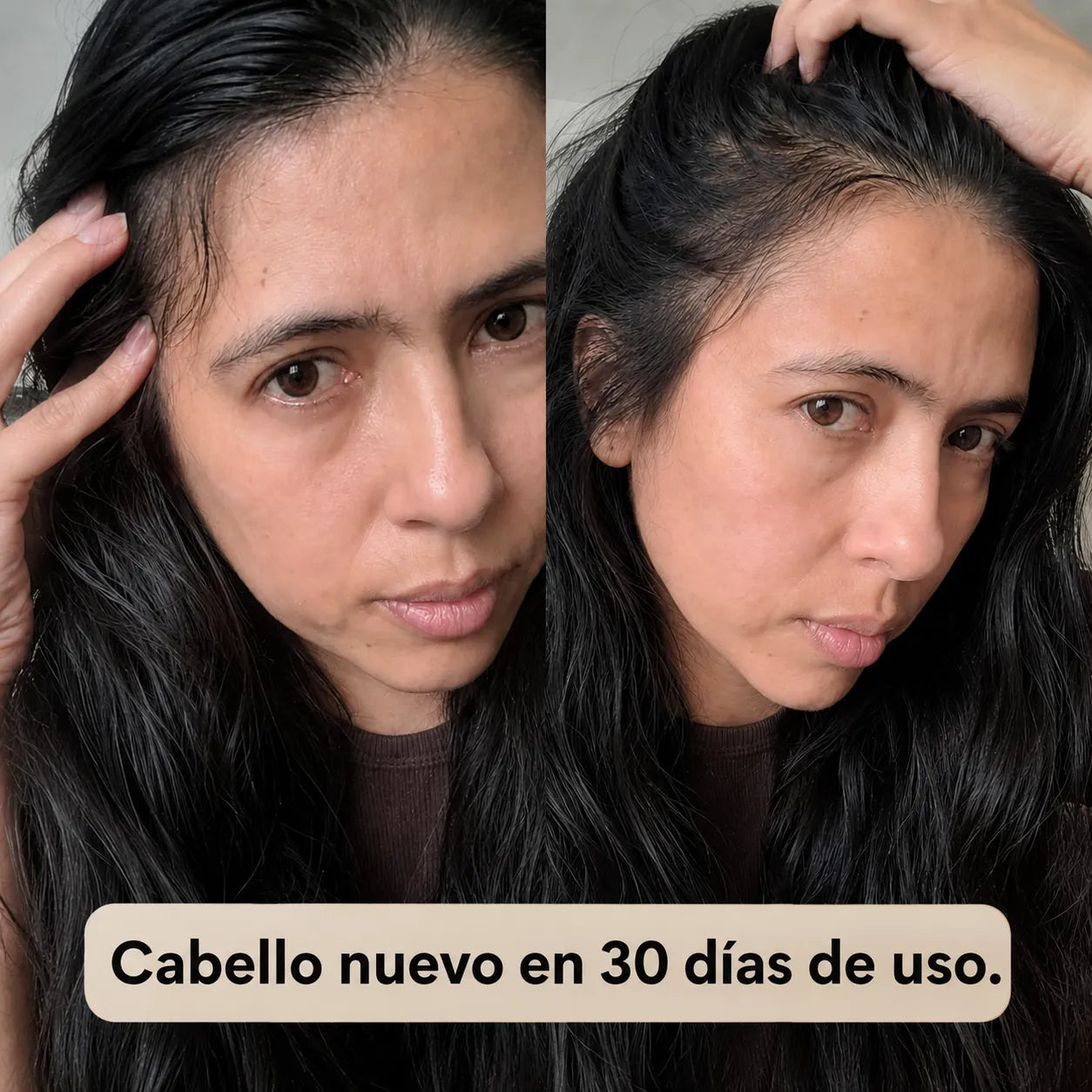 1. Shampoo Anticaida + Tratamiento